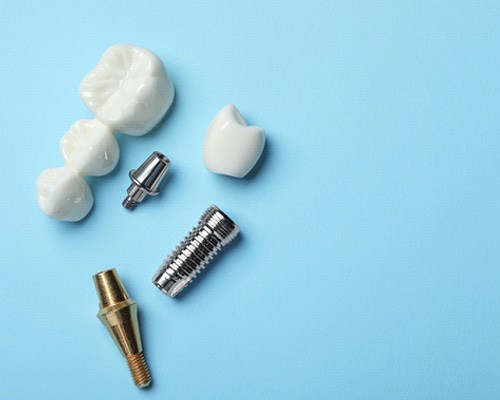 Birds eye view of the components of a dental bridge and implants on a light blue background