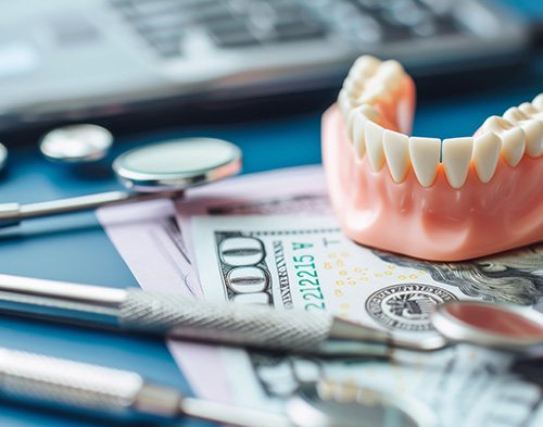 Rendering of an upper arch of implant dentures with a white background