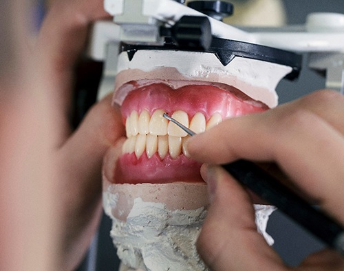 Dentures are made of durable acrylic in Jenks, OK